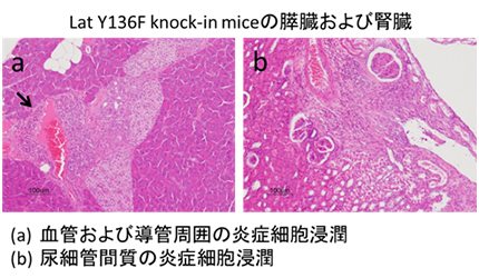 Lat Y136F knock-in miceの膵臓および腎臓
